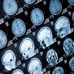 МРТ головного мозга: как делать, для чего нужно и сколько стоит в Москве?. Картинка 1