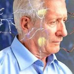 Пожилой мужчина с признаками рассеянного склероза