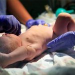 Причины и последствия церебральной ишемии у новорожденных